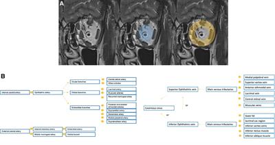 Vascular lesions of the pediatric orbit: A radiological walkthrough